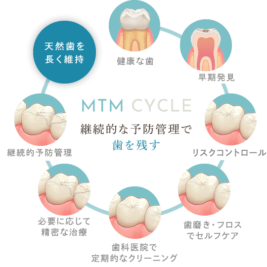 継続的な予防管理で歯を残す