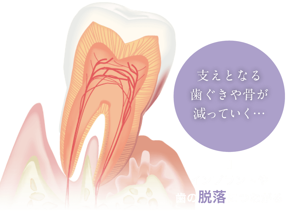 シミュレーション通りの埋入オペをアシスト