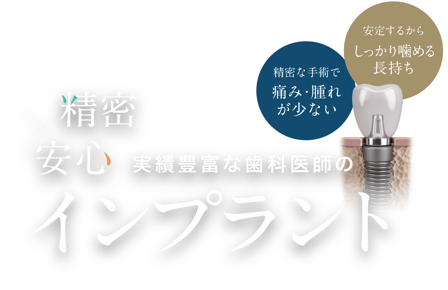 精密×安心 実績豊富な歯科医師のインプラント