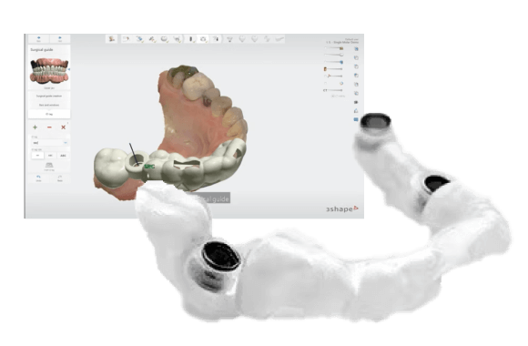 サージカルガイド