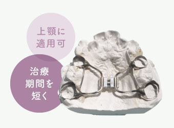 上顎に適用可/治療期間を短く